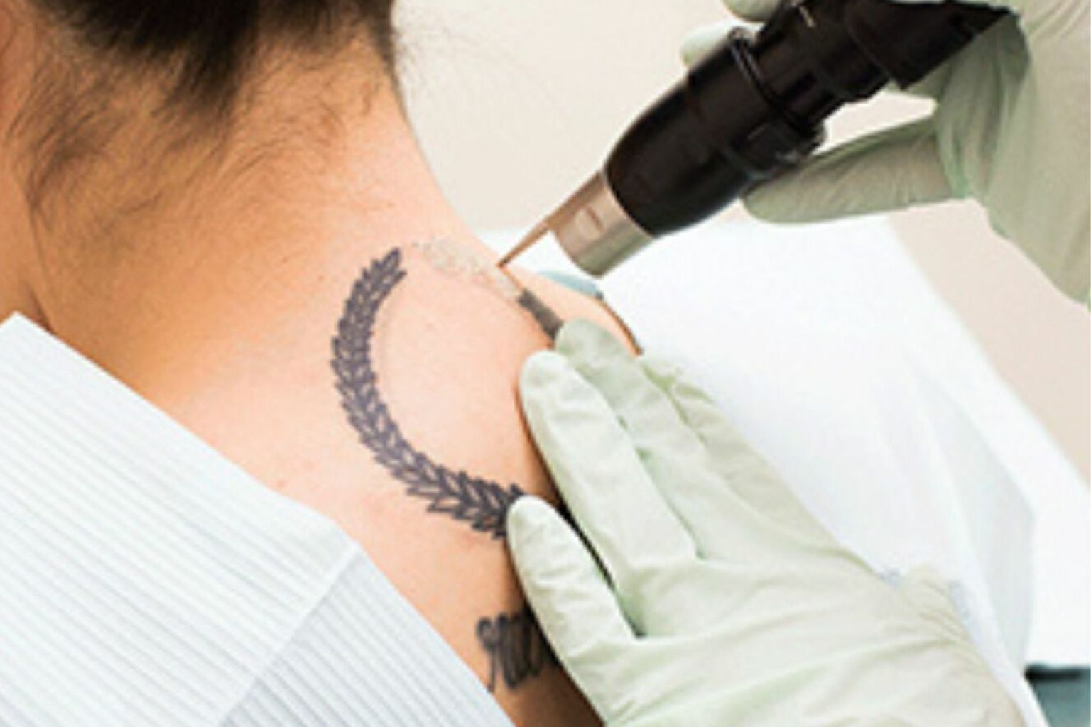 Tattoo Time Machine Laser Clinic 6 Untitled design 12