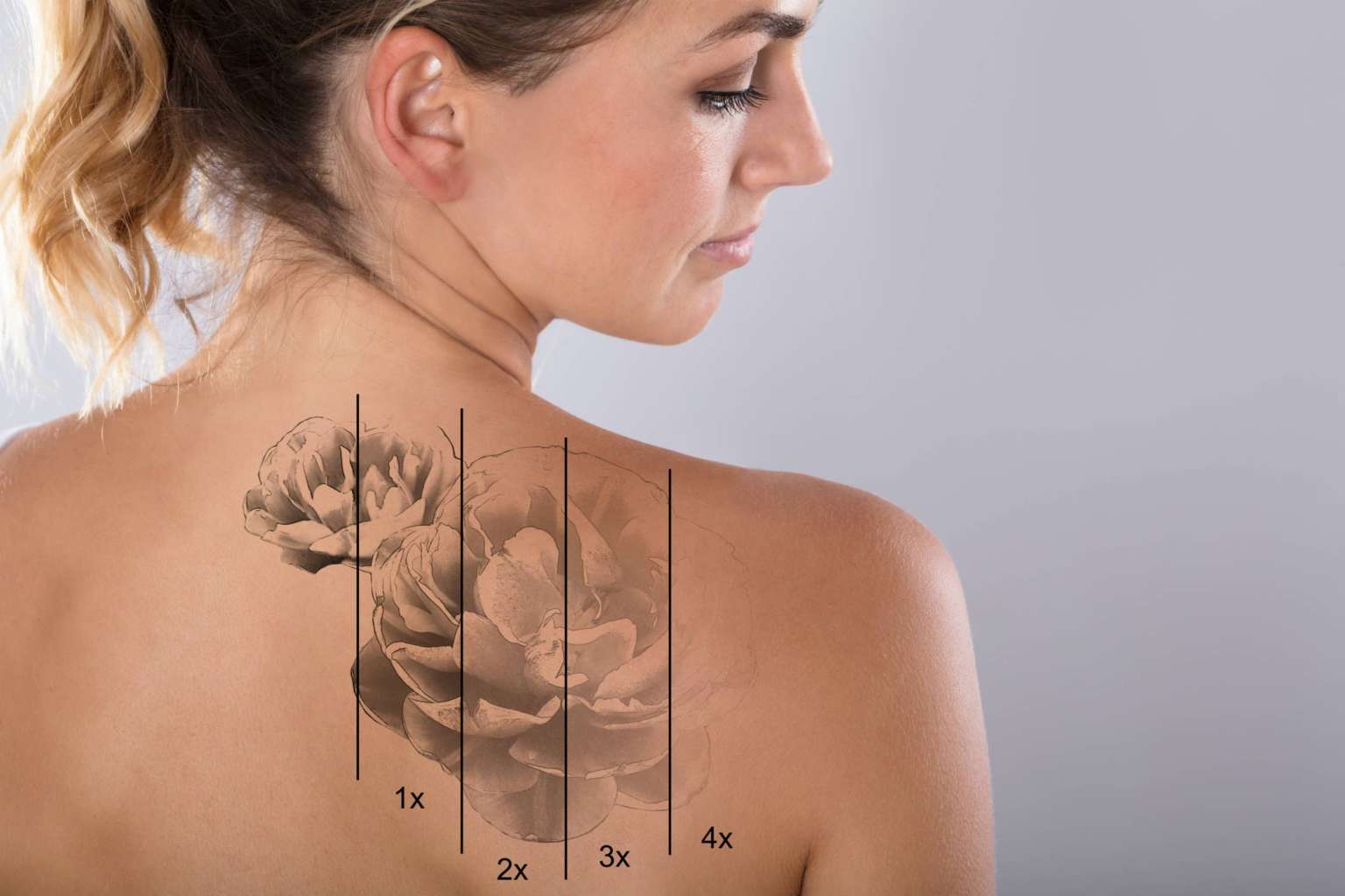 Tattoo Time Machine Laser Clinic 5 banner 4 1536x1024 1