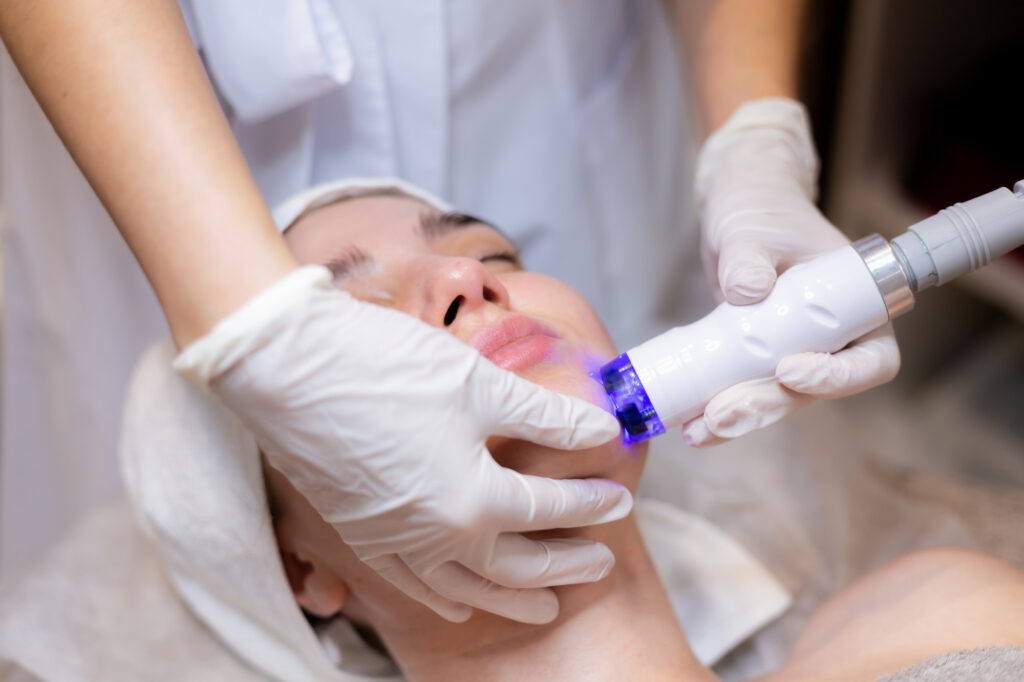 Facial laser skin treatment with protective goggles