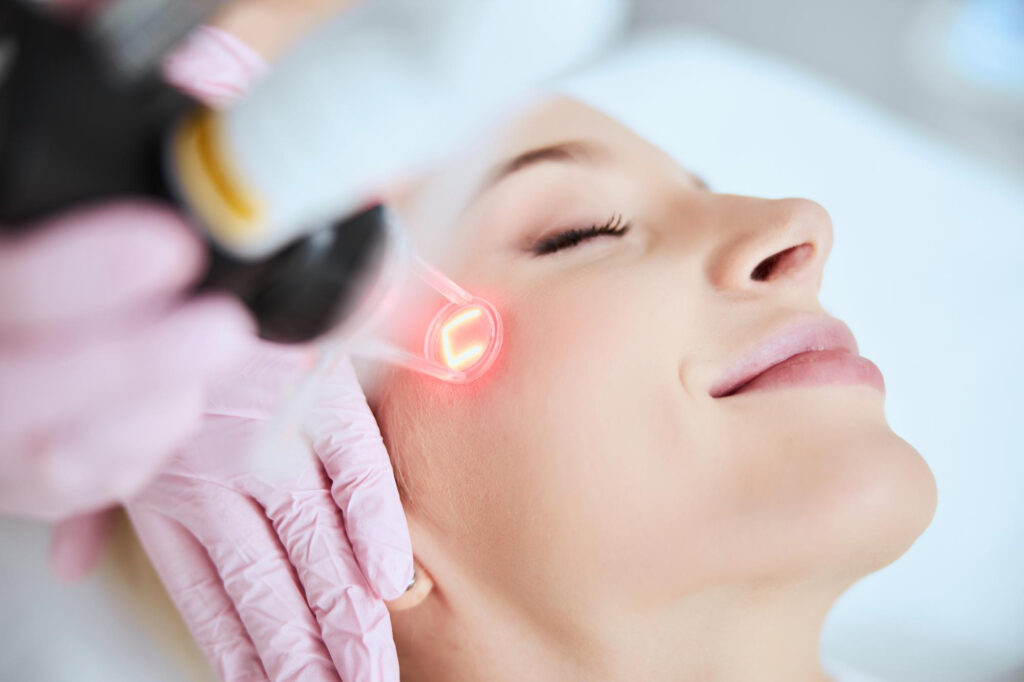 Laser treatment on the face near the eyebrow